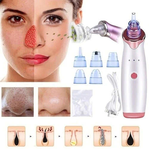 ✨ 4-in-1 Pro Multi-Function Blackhead & Whitehead Remover™