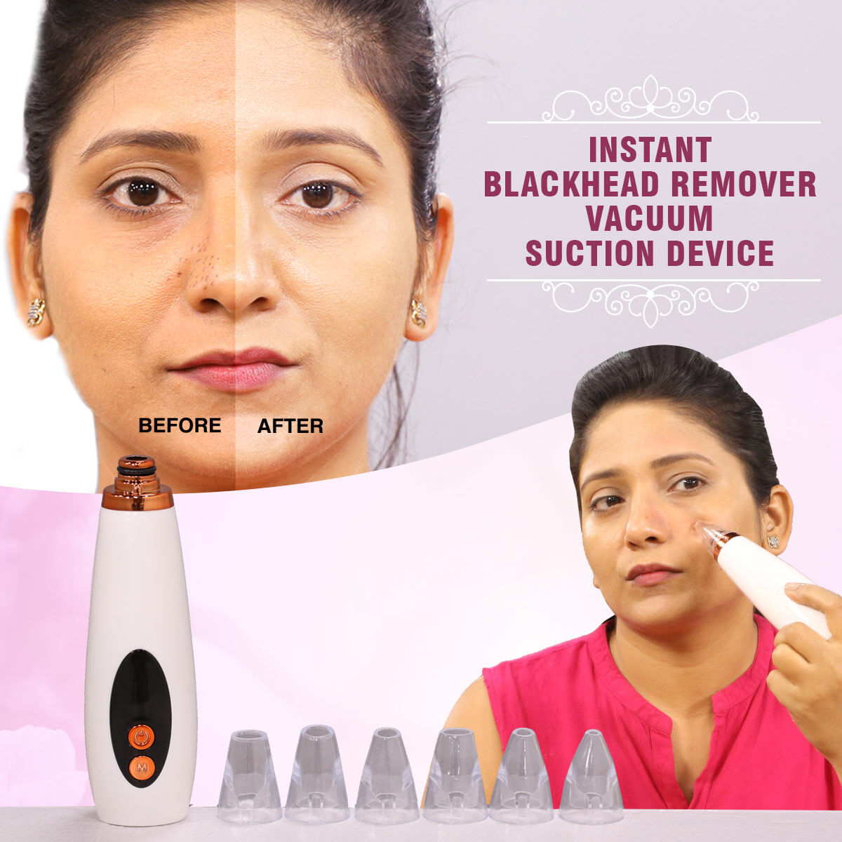 ✨ 4-in-1 Pro Multi-Function Blackhead & Whitehead Remover™